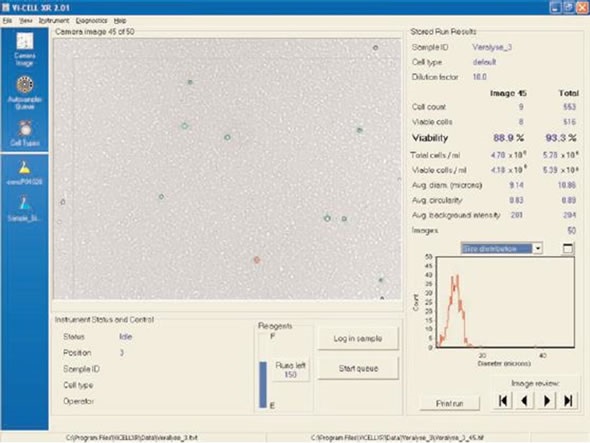 VersaLyse. Note RBC “ghosts” (white specs)