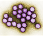 Adenovirus Infection Diagnosis