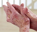 Immune molecule found to play a key role in regulating inflammation in rheumatoid arthritis