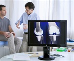 Personalized knee replacement: an interview with Dr Martin, Preferred Orthopedics of the Palm Beaches