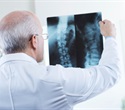 UC San Diego Health performs world’s first personalized spine surgery