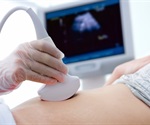 Breakthrough ultrasound sensor opens new possibilities for wearable medical devices