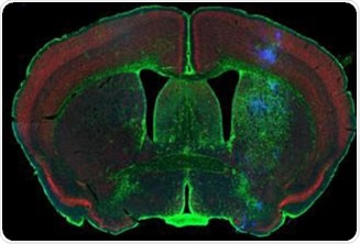 Rodent brain (top) depicting simultaneous acquisition of fluorophores Cy2, Cy3 and Cy5; Brain image (bottom) magnified to 0.5 μm