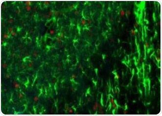 Rodent brain (top) depicting simultaneous acquisition of fluorophores Cy2, Cy3 and Cy5; Brain image (bottom) magnified to 0.5 μm