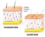 What is the Dermis?