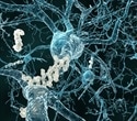 Research highlights a potential therapeutic strategy for vascular dementia