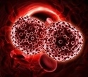 New medication offers potential treatment for patients with deadliest form of blood cancer