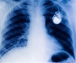 Fat fighting undermined by over active eating pacemaker