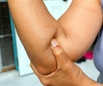 Elbow Pain Management