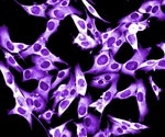 New insights into melanoma metastasis reveal potential drug target