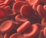 Researchers use stem cells from sickle cell disease patients to grow mature red blood cells
