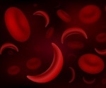 Sickle cell disease treatments: An interview with Dr Niihara, CEO of Emmaus Medical