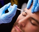 New use of Botox helps voice disorders