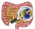 Small Intestinal Bacterial Overgrowth Diagnosis