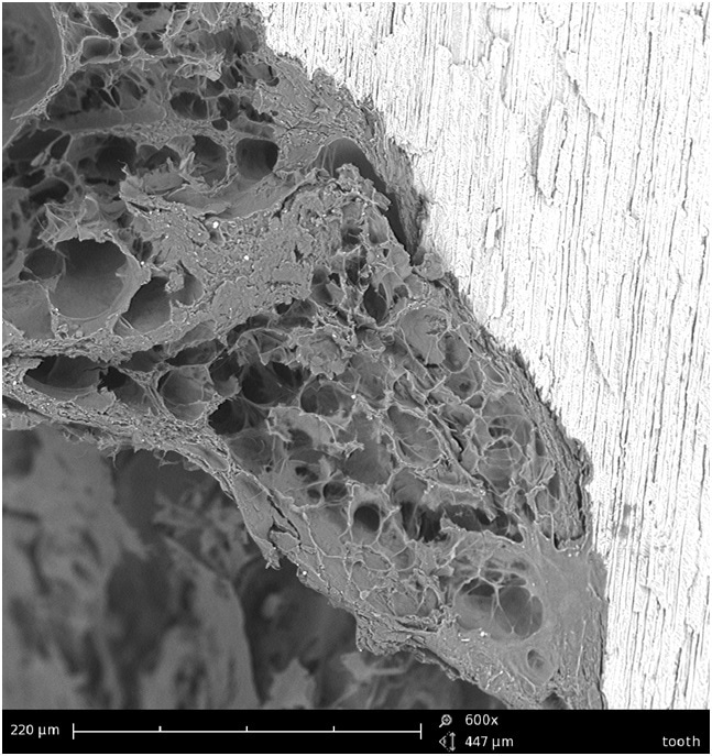Scanning electron microscopy (SEM)