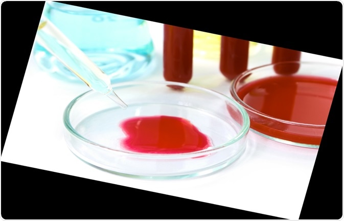 IKA® provided a UTTD control tube disperser to a customer, which helped resolve these two major issues. For instance, in Acute Organic Phosphorus Poisoning (AOPP) cases, forensic investigators have to gather and examine substances that are associated with the hophead, such as container of the pesticide, his/her leftover, vomit, drinks, gastric juice, urine, blood, lung, kidney, liver, and so on.