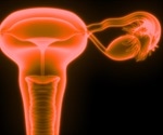Ovarian Cancer and Genetics