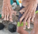 Genetic analysis shows leprosy was endemic in pre-colonial America