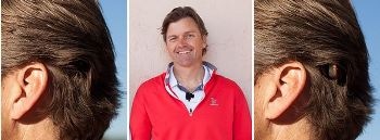 Baha Attract System from Cochlear