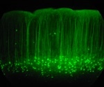 GFP-tagging in Fluorescence Microscopy