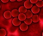 Key molecular signal allows malarial parasites to target human red blood cells