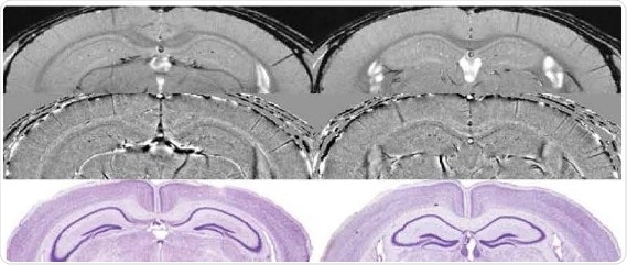 Comparison of micro-structures in the mouse brain measured at 15.2 T by using high resolution SWI with histological Nissle staining (below}.