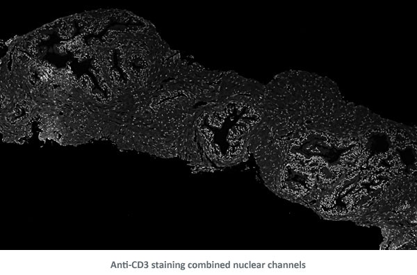 AntiCD3 CombNucChan