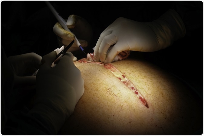 Image Credit: Casa Nayafana / Shutterstock