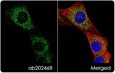 PDK1 staining of NIH/3T3 cells. Anti-mitochondrial pyruvate dehydrogenase kinase 1 antibody (ab202468) was used at a dilution of 1/1000 with goat anti-rabbit IgG (Alexa Fluor 488) secondary antibody (ab150077). Cells were counterstained with DAPI (blue) and  tubulin also stained (red).