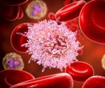 Hidden cell structures reveal a common weakness in leukemia