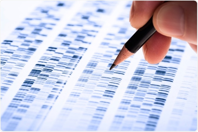Scientist analyzes DNA gel used in genetics, forensics, drug discovery, biology and medicine. Image Credit: Gopixa / Shutterstock