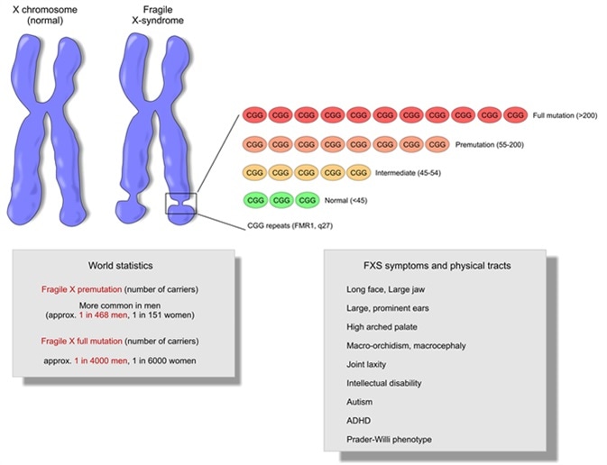 Fragile X syndrome, a genetic disorder of the X chromosome (FMR1 gene) and main symptoms and pathologies correlated. Image Credit: ellepigrafica / Shutterstock
