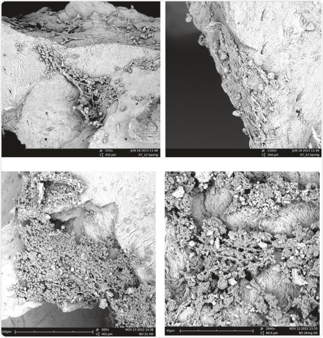 examples of SEM of human osteoblasts seeded on cancellous bone