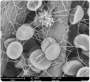 High-resolution SEM imaging of blood cells.