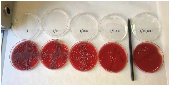 Colony counting on agar plates. A dilution series of C. albicansspiked into whole blood, plated and counted by eye.