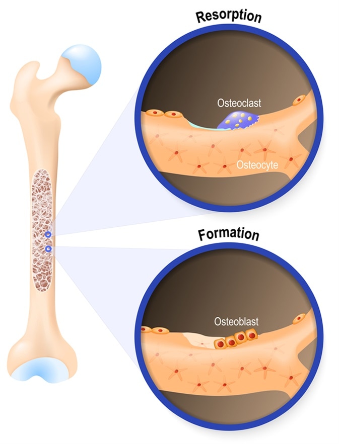 Osteoblast and osteoclast. The bone remodeling process. In a healthy body, osteoclasts and osteoblasts work together to maintain the balance between bone loss and bone formation. Image Credit: Designua / Shutterstock