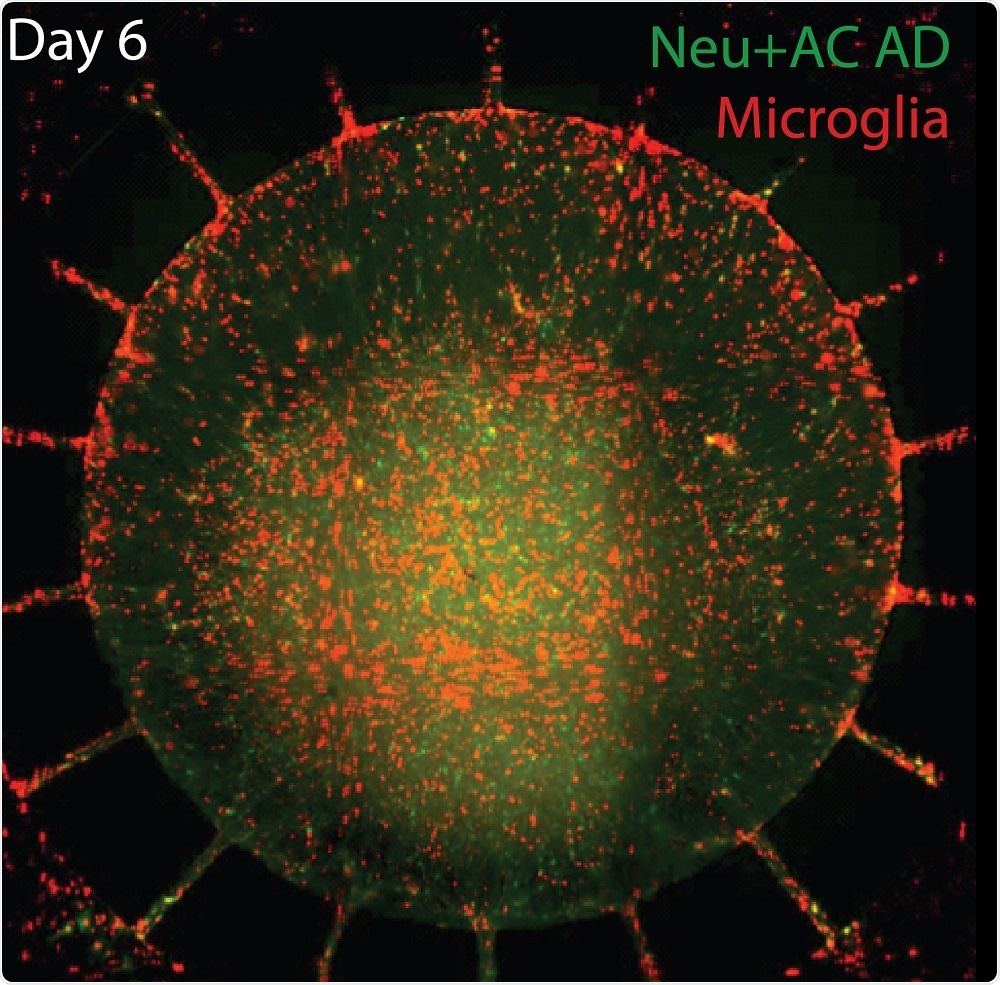 Six days after activated microglia (red) were added to the outer chamber of the new microfluidic device, the inflammatory cells migrate through channels into the inner chamber, containing cultured neurons and astrocytes (green) with gene variants associated with familial Alzheimer