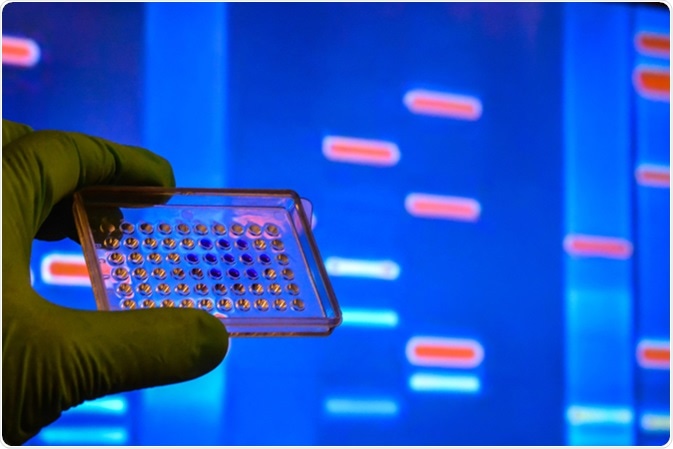 DNA testing in a scientific laboratory. Genome research using modern biotechnology methods. Image Credit: Sergei Drozd / Shutterstock