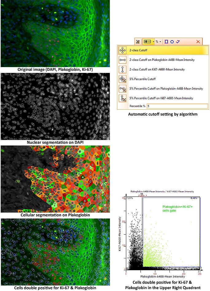 Segmentation on Plakoglobin