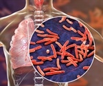New TB vaccine effective in half of the population in phase II trials