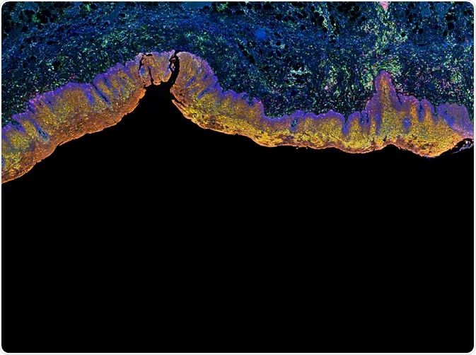 Fluorescent tissues stained using IHC Techniques - By Carl Dupont