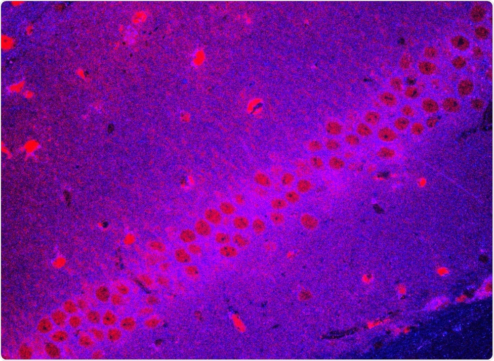 Organoid brain - murine