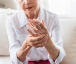 Can Arthritis Affect Skin?