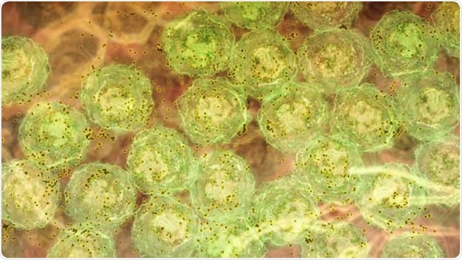 A discovery about how the immune system responds to malaria infection could lead to better treatments for hepatitis C, HIV and lupus. The research showed, in laboratory models, that strong inflammatory signals caused by malaria infection activate molecules that trigger B cells to produce highly potent antibodies to fight the disease. In this image, we see B cells (green) producing antibody (brown). The same inflammatory signals are seen in human malaria infections, chronic viral infections and autoimmunity. This suggests the discovery could be harnessed to develop new vaccines and therapies that are better able to fight infections such as hepatitis C and HIV, and treat diseases such as lupus. Image Credit: Walter and Eliza Hall Institute