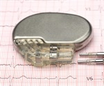 New type of bionic pacemaker