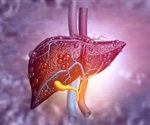 Using math equations to detect and forecast liver cancer risk