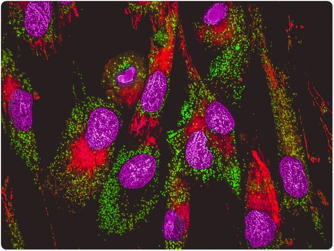 epithelial to mesenchymal transition