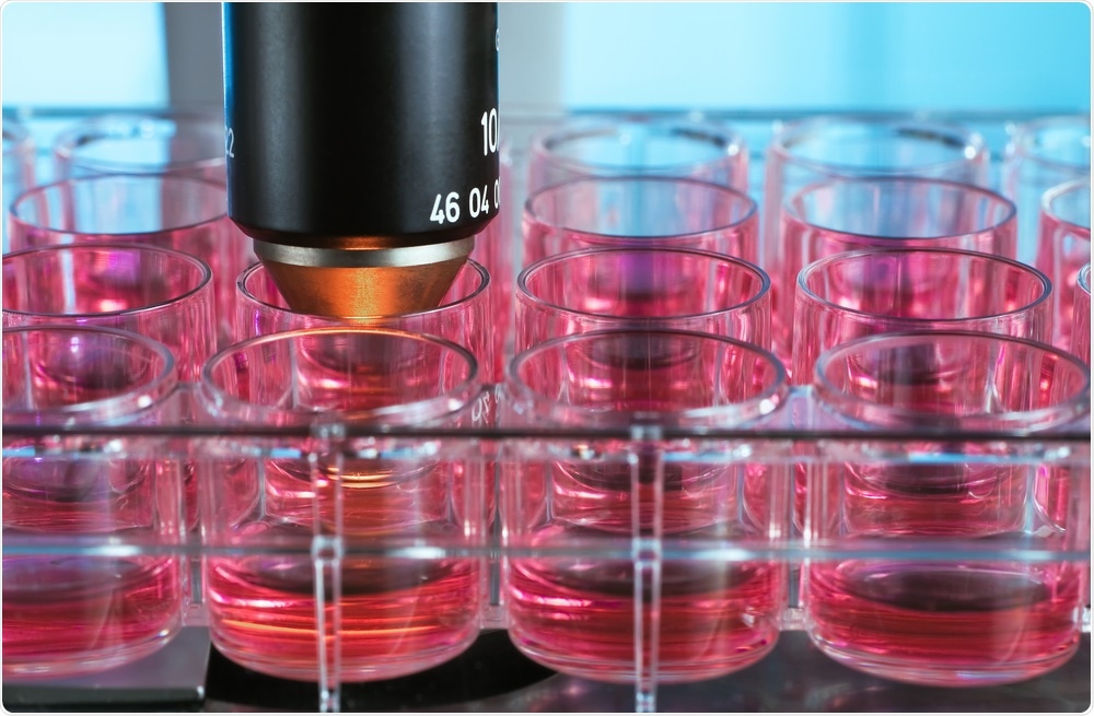 Microscopic observation of cells in culture.