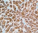 Multicolor Immunohistochemistry (IHC): Going Beyond a Single Color