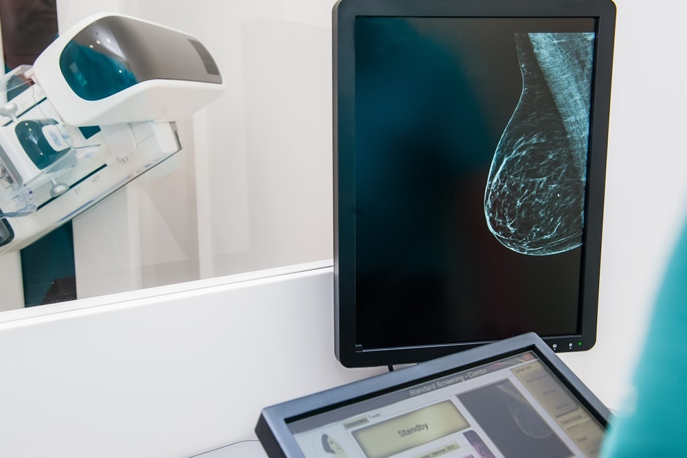 mammogram